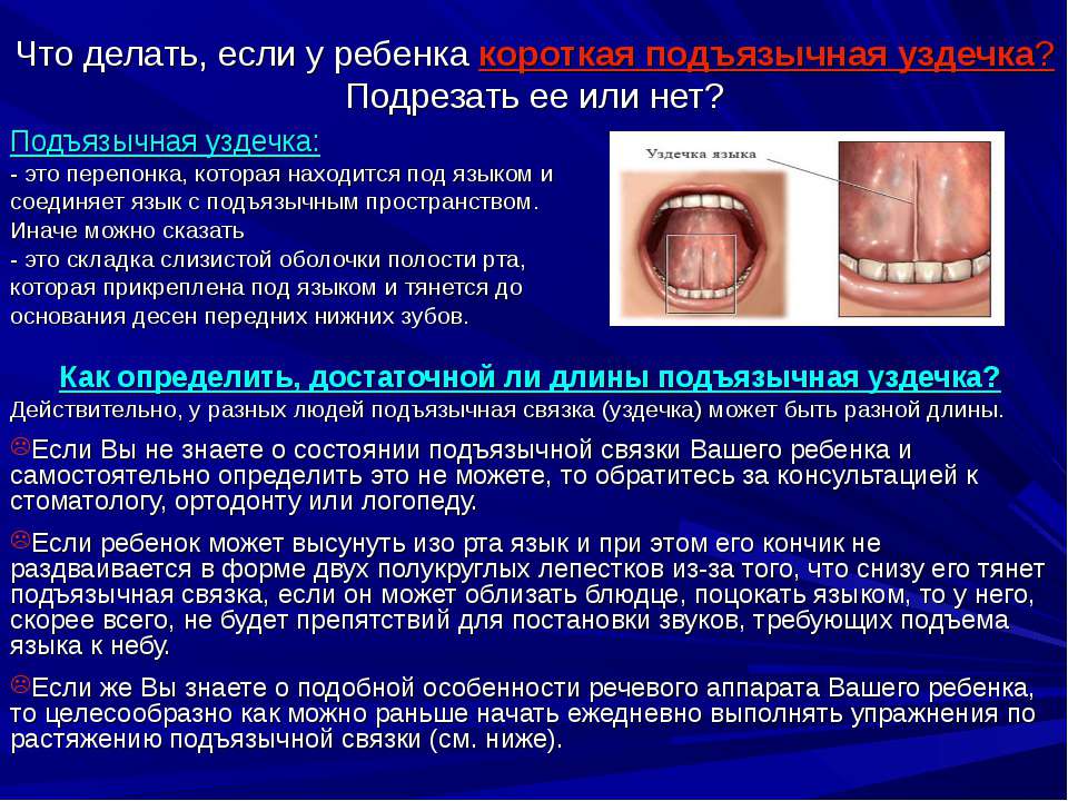 Что делать, если у ребенка короткая подъязычная уздечка? - Скачать Читать Лучшую Школьную Библиотеку Учебников (100% Бесплатно!)