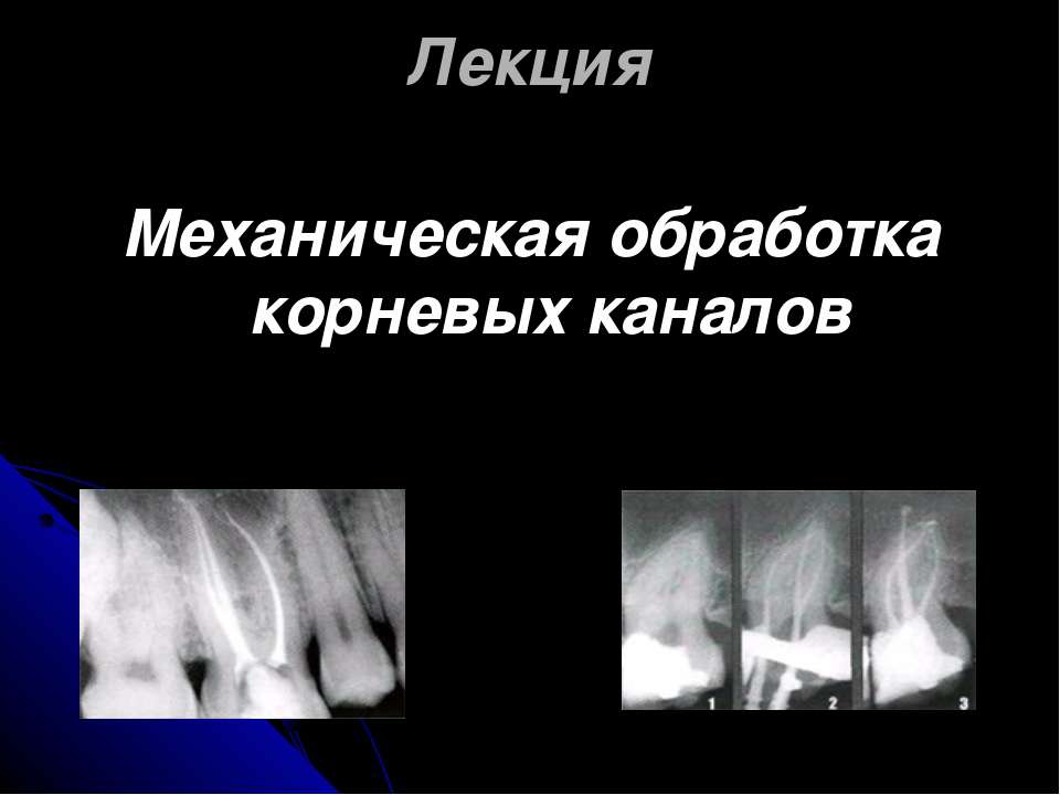 Механическая обработка корневых каналов - Скачать Читать Лучшую Школьную Библиотеку Учебников